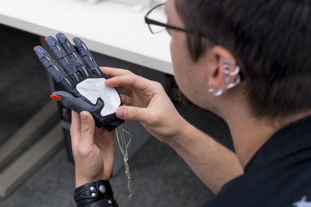Handprothese aus dem 3-D Drucker