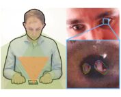 Eine Person schaut auf ein Telefon. Das Bild, das mit der Hochschule Coburg in Verbindung steht, ist geteilt und zeigt rechts eine Nahaufnahme des Auges mit hervorgehobenen Bereichen. Geometrische Überlagerungen suggerieren Fokus oder Analyse und deuten möglicherweise auf Eye-Tracking oder visuelle Aufmerksamkeitsforschung hin.