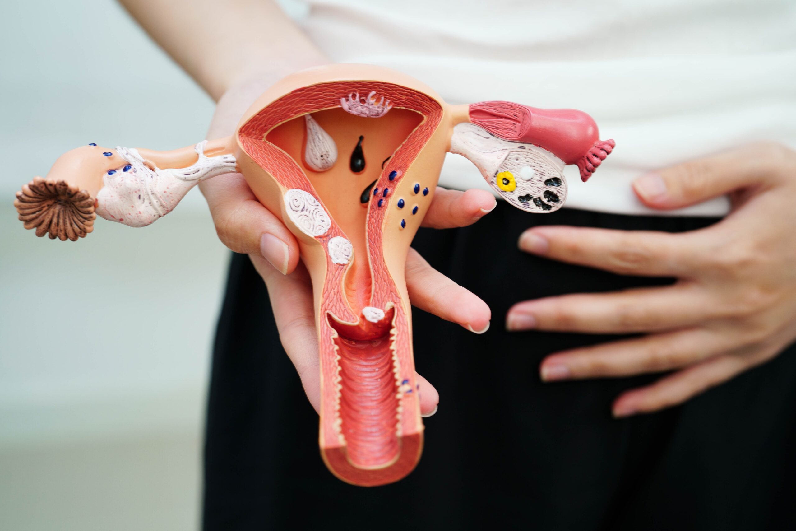 Eine Person hält ein detailliertes anatomisches Modell des weiblichen Fortpflanzungssystems, auf dem die von Endometriose und Adenomyose betroffenen Bereiche hervorgehoben sind, und stützt ihre Hände auf den Unterleib - perfekt für einen Themenabend zur Frauengesundheit. at Hochschule Coburg